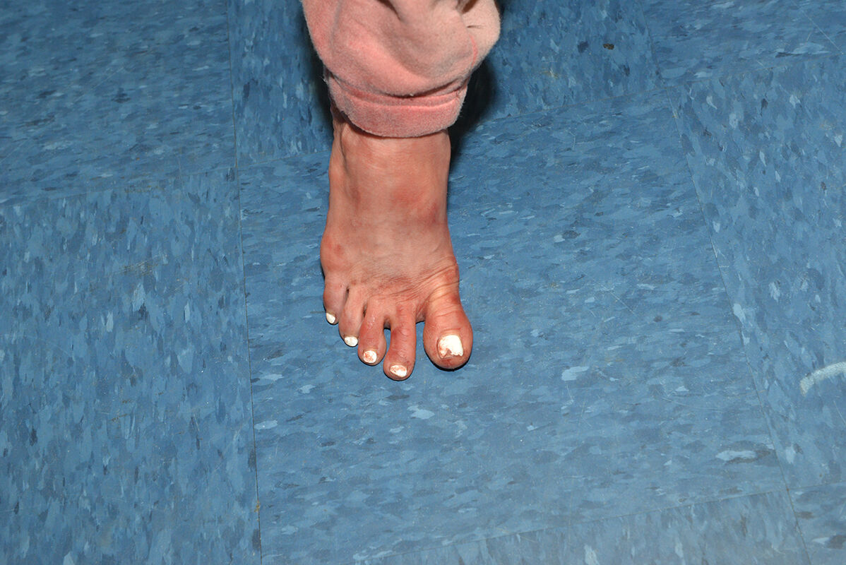 Clenney Crime scene photo of foot
