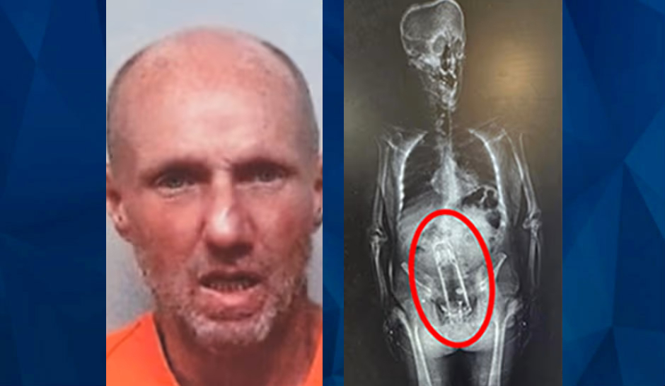 Florida Man Found With Large Thermos up Rectum After 26th