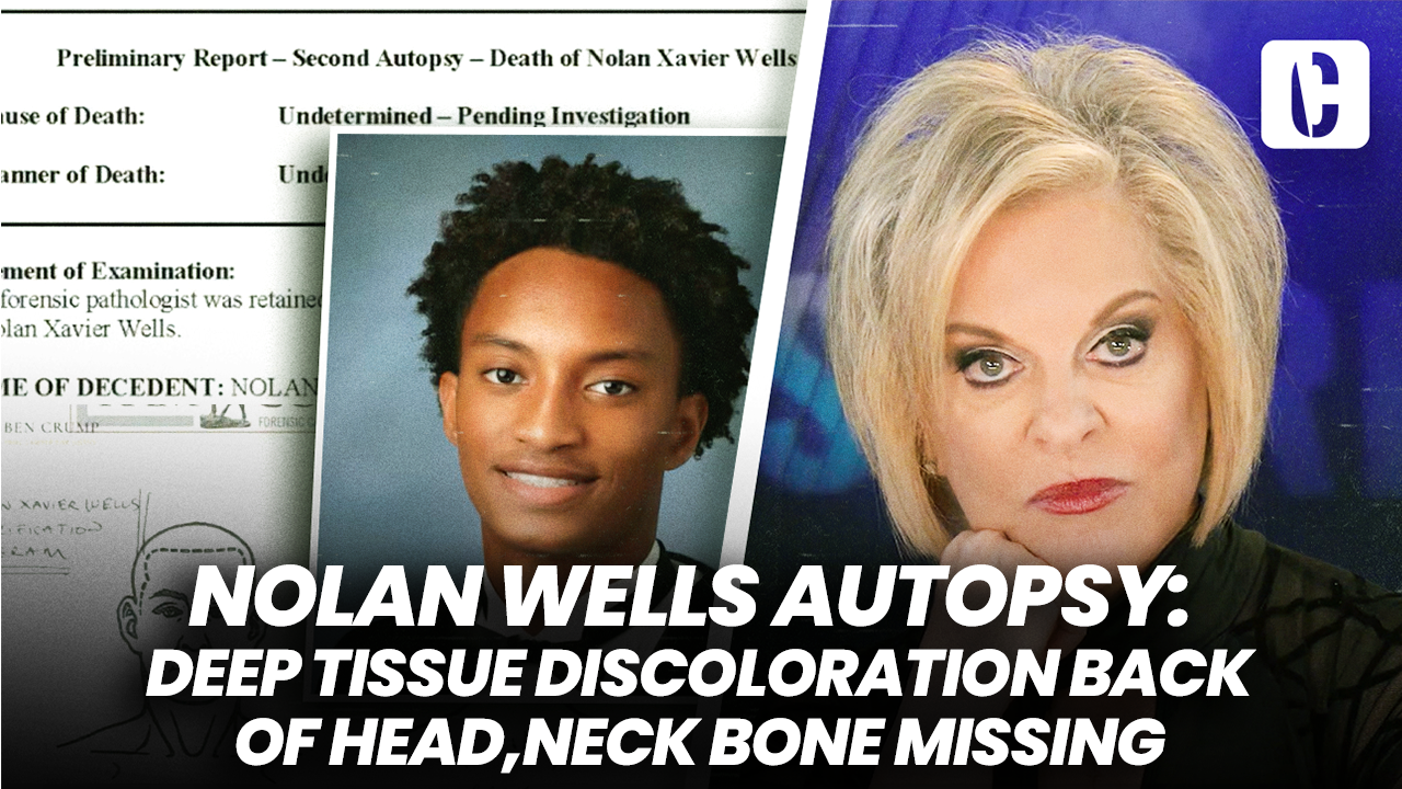 NOLAN WELLS AUTOPSY: DEEP TISSUE DISCOLORATION BACK OF HEAD, NECK BONE MISSING